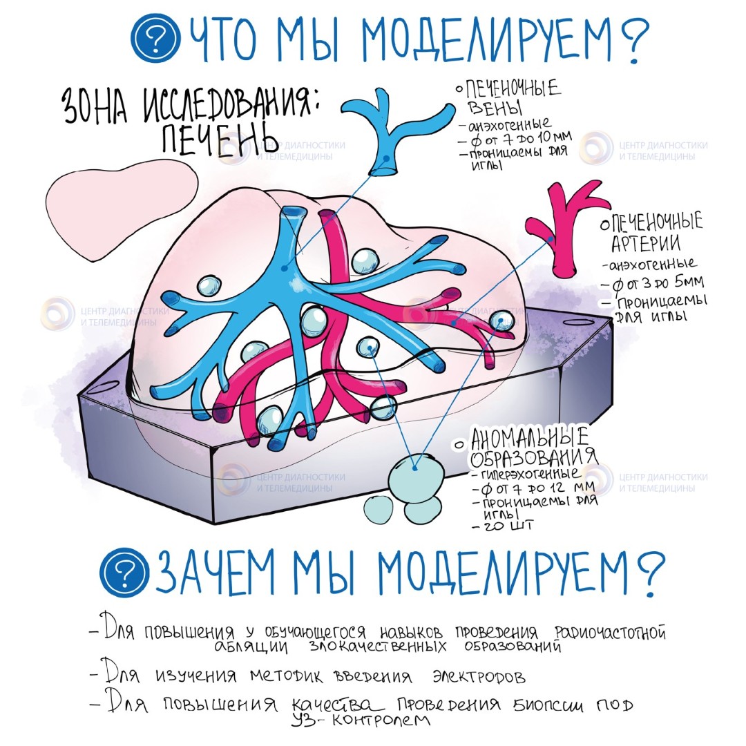 Фантом печени для УЗ диагностики и манипуляций
